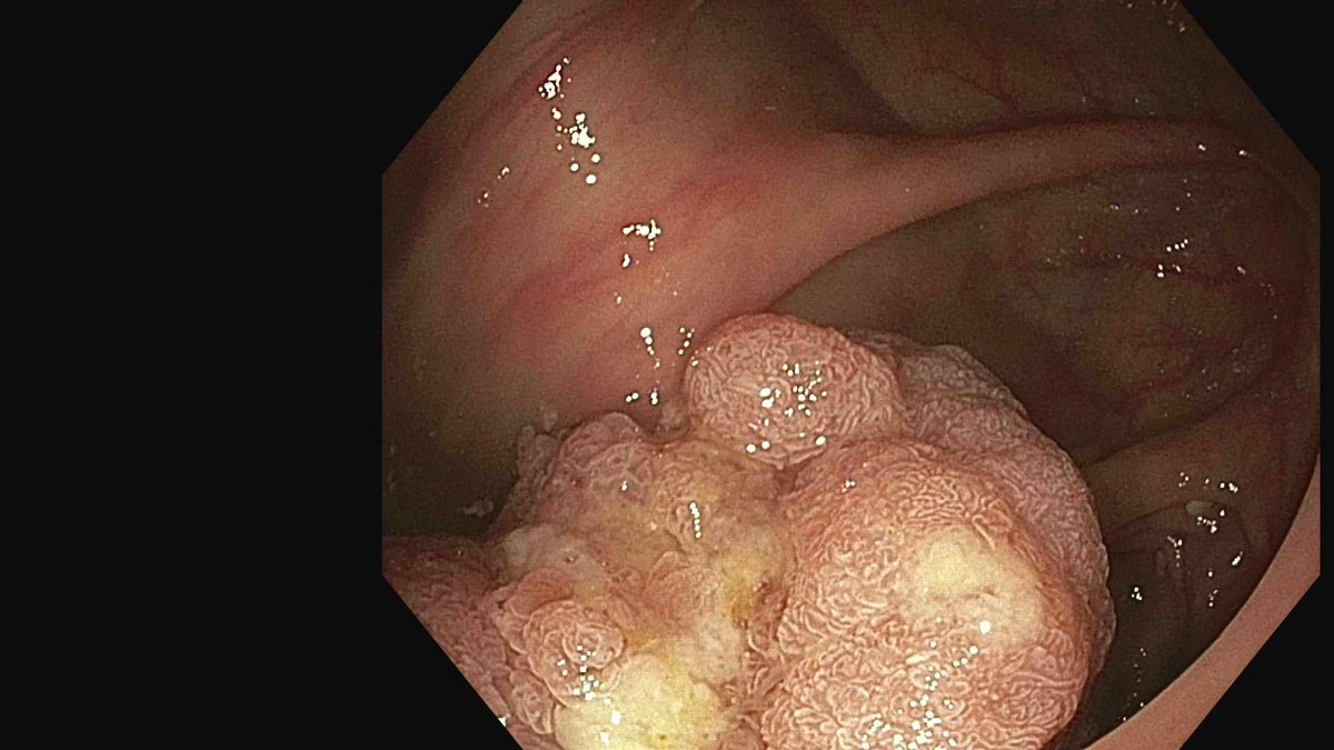 Douglas G. Adler MD, FASGE, FACG, AGAF tweet media