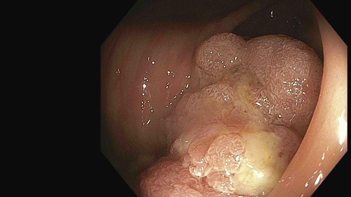 Douglas G. Adler MD, FASGE, FACG, AGAF tweet media