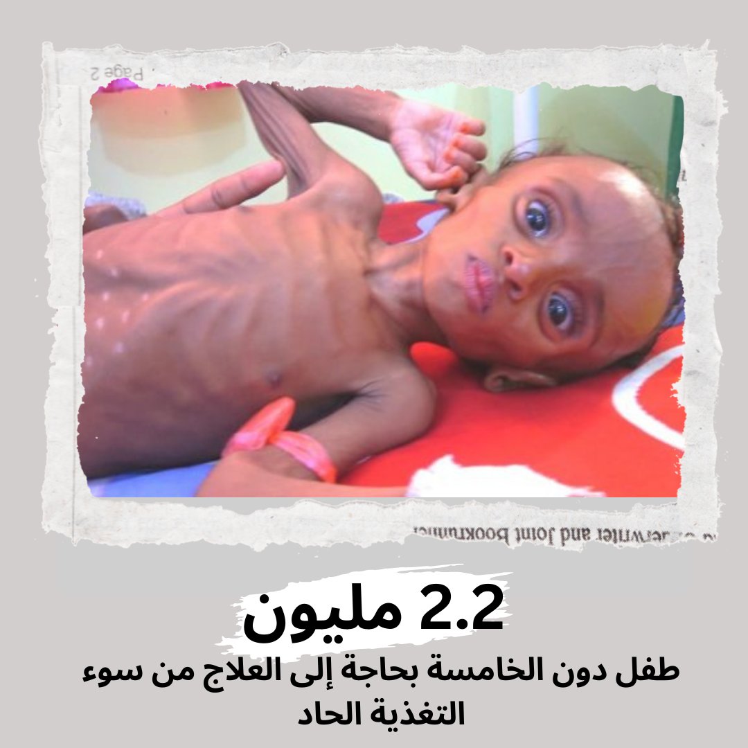 Malnutrition rates among women and children in Yemen are among the highest in the world, with 1.3 million pregnant or breastfeeding women and 2.2 million children under five requiring treatment for acute malnutrition.
#WorldFoodSafetyDay #Yemen