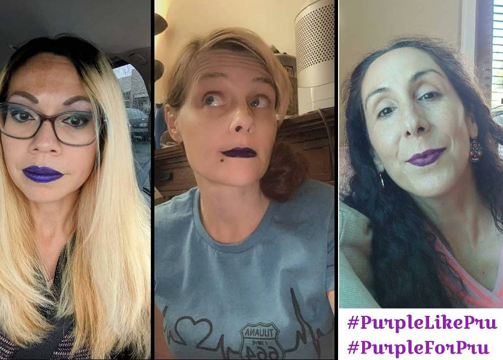 YogaWithCriss's tweet photo. De izquierda a derecha:
Mo, Pru y yo, cuando Pru tenía como un mes en tratamiento. Hasta mi esposo, que adora a Pru, se tomó una foto con lipstick morado para mostrar su solidaridad.
#PurpleForPru https://t.co/X5bWhOYf7O
