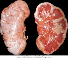 Nephrology19's tweet photo. More #Evidence of #Acute #Kidney #Injury from #Intravenous #Iodinated Contrast Material
Read more: https://t.co/w9ocegzRCu
share your paper on: https://t.co/1BwLYUVD62
#oain
#Manuscripts
#research
#Acute #Kidney #Injury
#USA https://t.co/CaFzcOsJdt