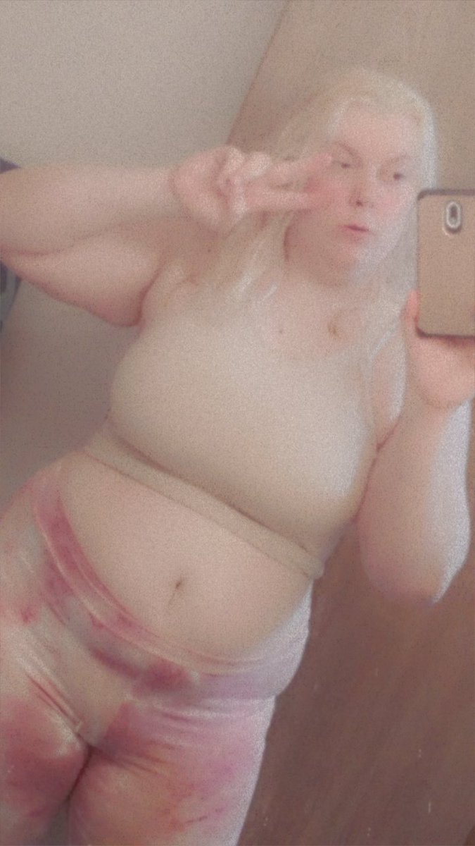 xrei04's tweet photo. :) its been awhile and hard to come to terms with but i love my body the way it is. https://t.co/p8IUOEfegK