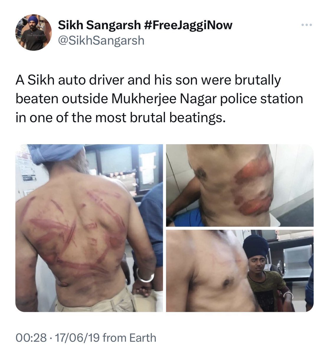 साक्षी मलिक जी जो फ़ोटो डाल कर अपने टुल किट गैंग वालों से रीट्वीट करवा रही हो उनसे कहना ये फ़ोटो 2019 की दिल्ली के आटो ड्राइवर के साथ मारपीट वाला घटना की है 

जैसे ये फ़ोटो तुम्हारे द्वारा डाला गया झूठा है वैसे ही पेलवानों का आंदोलन भी झूठा है