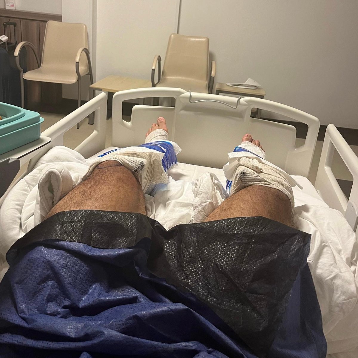 GAFollowers's tweet photo. 33y/o Brian Sanchez, a mortgage broker in Georgia flew to Turkey and spent $100,000+ to get a leg lengthening surgery to add 7 inches to his height. 

He was 6'0 before the surgery. https://t.co/3MqqxAcOwN