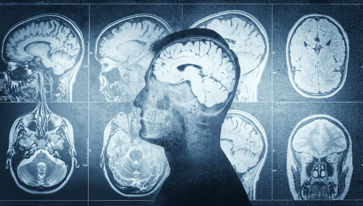 #saluden5tuits | Día Internacional de los Tumores Cerebrales

🧠 Los tumores del sistema nervioso central resultan del crecimiento descontrolado de células en el cerebro o la médula espinal. Pueden ser primarios o metástasis.

#DíaInternacionalTumoresCerebrales