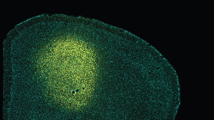 UniBarcelona's tweet photo. #RecercaUB | 🧠 Un equip de l’@ubneuroscience identifica noves alteracions en circuits neuronals en la malaltia de #Huntington. L’estudi permet aprofundir en els símptomes de la malaltia i d’altres patologies neurodegeneratives.
👩🔬 Lidera la recerca @mercemasana i @saracondebe és la primera autora.
👉 https://t.co/6dMiWFE3dW