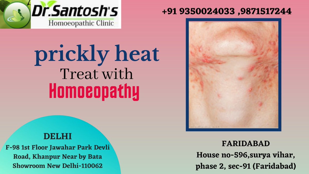 A skin condition caused by blocked sweat ducts and trapped sweat beneath the skin. 

#PricklyHeat #HeatRash #SummerSkinCare
#SkinRash #HeatBumps #PricklyHeatRemedy
#CoolingTips #SummerSkincareTips #HeatRelatedSkinIssues #SweatRash

Call us-9350024033/9871517244