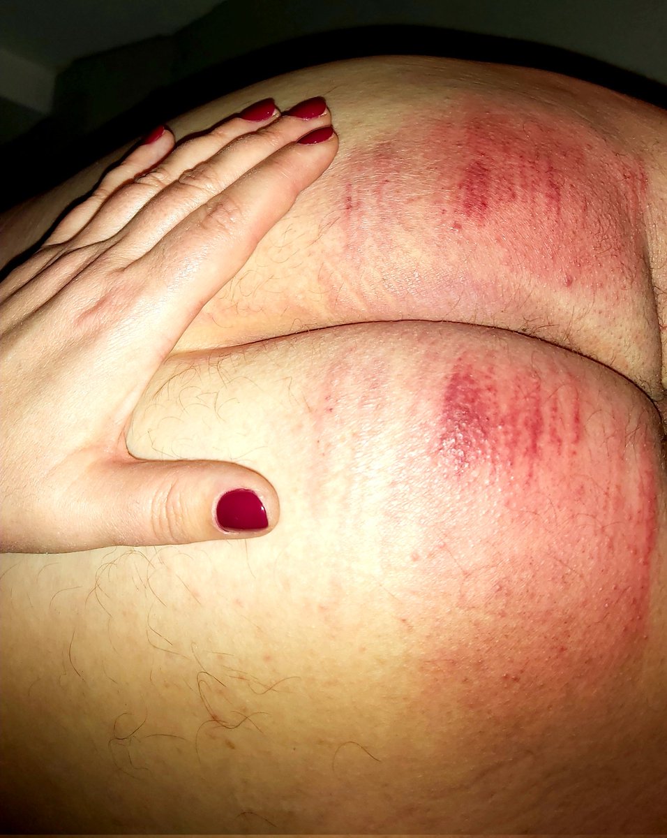 agent_ida's tweet photo. 24 strokes with the heavy cane while bent over Matron's desk,
followed by 12 strokes with the bathbrush while over Matron's knees.
Will he now listen and stop smoking those expensive cigars? Or will he reoffend?

#disciplineme #caning #otk #CIGARS https://t.co/ZeTlP4NYSQ