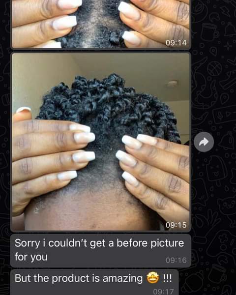 DermaSolutiongh's tweet photo. 2 for Ghc 60 p3✅️✅️

Anti-dandruff hair cream 

Treats dandruff and all scalp psoriasis

💯 effective

DM or Call 0205773069 

Kindly Retweet 🙏 

#Dermasolution
#HBDPhilan  Prof. Frimpong Boateng 
Bawumia https://t.co/vLykGEUJAO