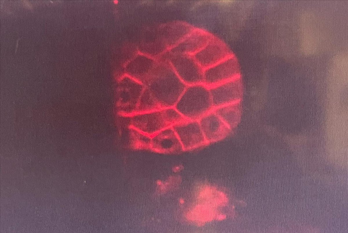 MichelleItano's tweet photo. #GuessTheIllumination #micoscopymonday #firstimages #embryo23 https://t.co/WcgR0B3JmP