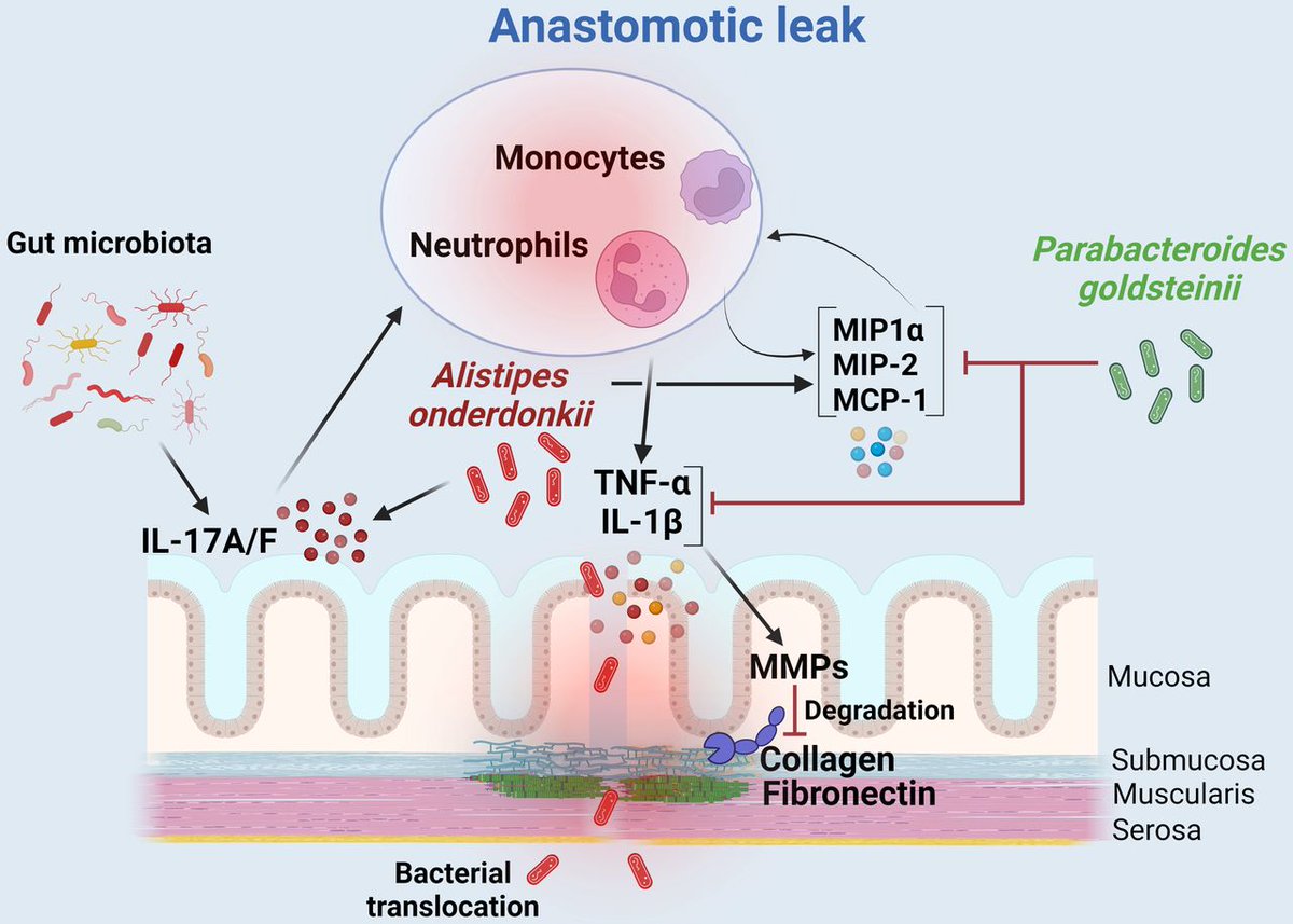 Gut Journal (@gut_bmj) on Twitter photo #GUTImage from the paper
"Gut microbiota influence anastomotic healing in colorectal cancer surgery through modulation of mucosal proinflammatory cytokines" via
bit.ly/3pFCjCL
<a href="/Roy__Hajjar/">Roy Hajjar</a>, <a href="/GonzalezEmBio/">Emmanuel Gonzalez</a>, <a href="/NJBBrereton/">Nicholas Brereton</a>, <a href="/Nut_Microb_Lab/">Nutrition and Microbiome Laboratory</a> #ColorectalCancer #Microbiota #GUTImage from the paper
"Gut microbiota influence anastomotic healing in colorectal cancer surgery through modulation of mucosal proinflammatory cytokines" via
bit.ly/3pFCjCL
<a href="/Roy__Hajjar/">Roy Hajjar</a>, <a href="/GonzalezEmBio/">Emmanuel Gonzalez</a>, <a href="/NJBBrereton/">Nicholas Brereton</a>, <a href="/Nut_Microb_Lab/">Nutrition and Microbiome Laboratory</a> #ColorectalCancer #Microbiota