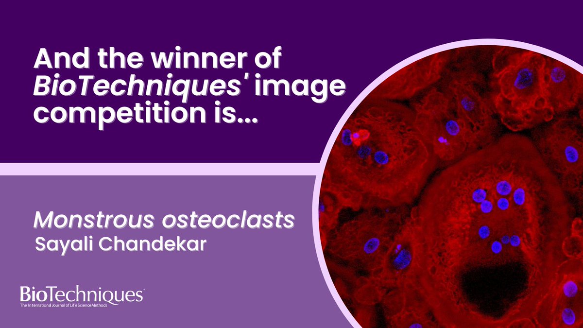📸 We are very pleased to announce that the winner of this year’s image competition is Monstrous osteoclasts, submitted by <a href="/Chandekarsay9/">Sayali Chandekar</a>! 🤩

biotechniques.com/life-science-e…