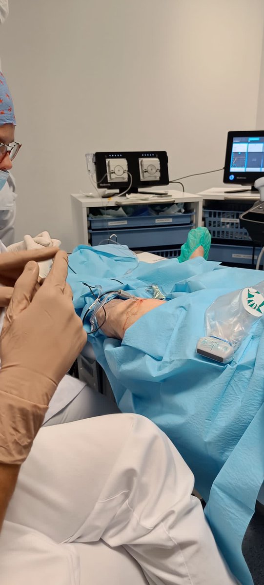 Hoy en nuestra unidad, jornada de radiofrecuencia enfriada de nervios geniculados con @MedtronicES