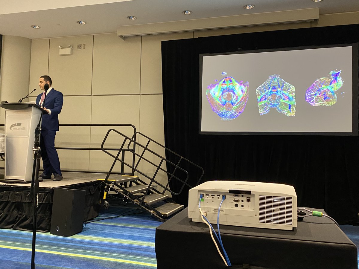 giancarlomignu1's tweet photo. Had a blast in Toronto, #Canada 🇨🇦 presenting our cadaveric #whitematter research at the annual @ISMRM meeting. Congratulations to all co-authors for their hard work and beautiful #tractography and FA map images. #ISMRM2023 #Neurosurgery #research
@BarrowNeuro 
@hanalioglu https://t.co/OFVlG4cNiO