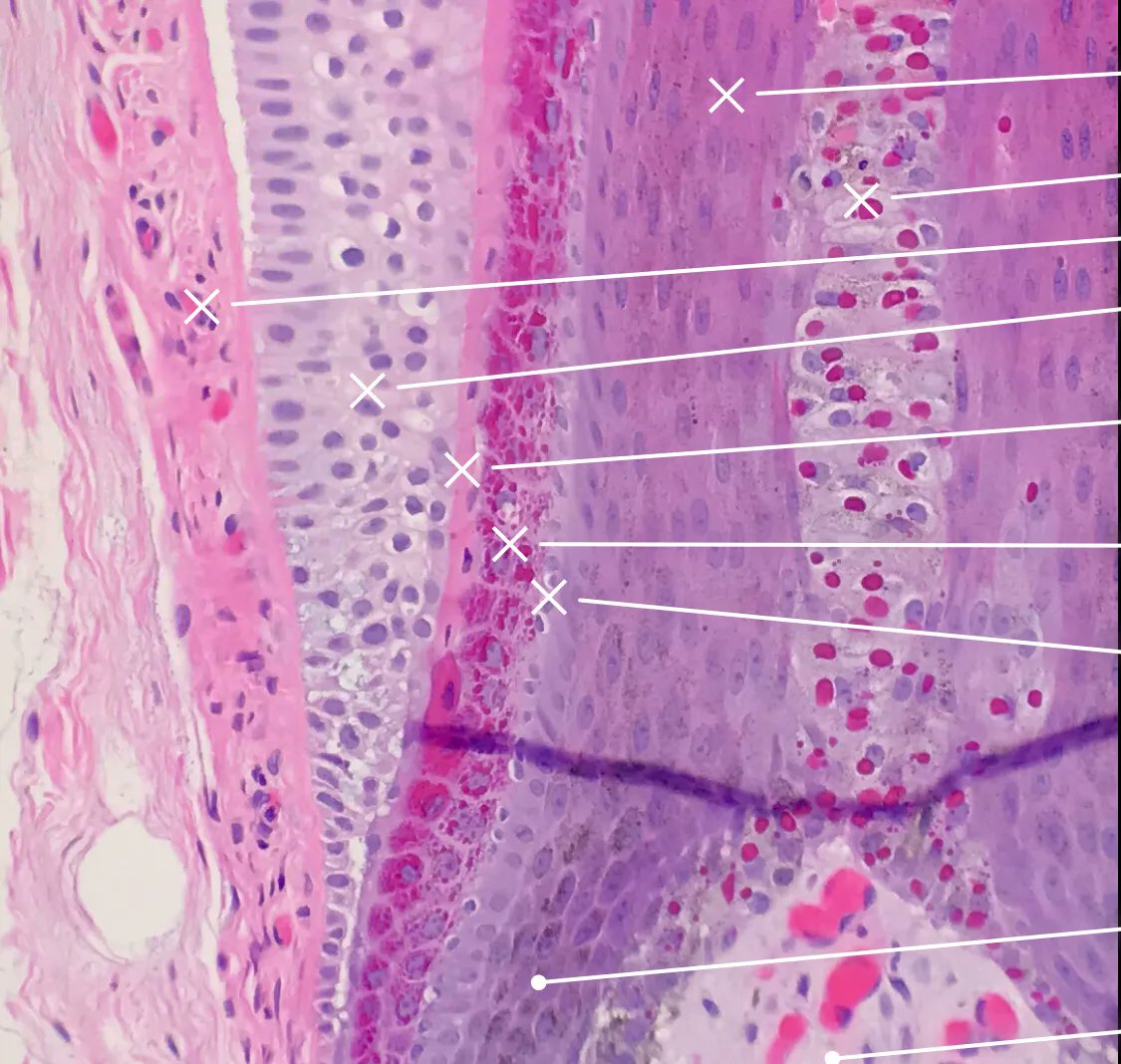 Quiz: Do you know all the layers of a hair follicle bulb/root? Answers: kikoxp.com/posts/7899. See also my scalp skin & hair follicle #histology video: kikoxp.com/posts/7898 #pathology #pathologists #pathTwitter #dermpath #dermatology #dermtwitter