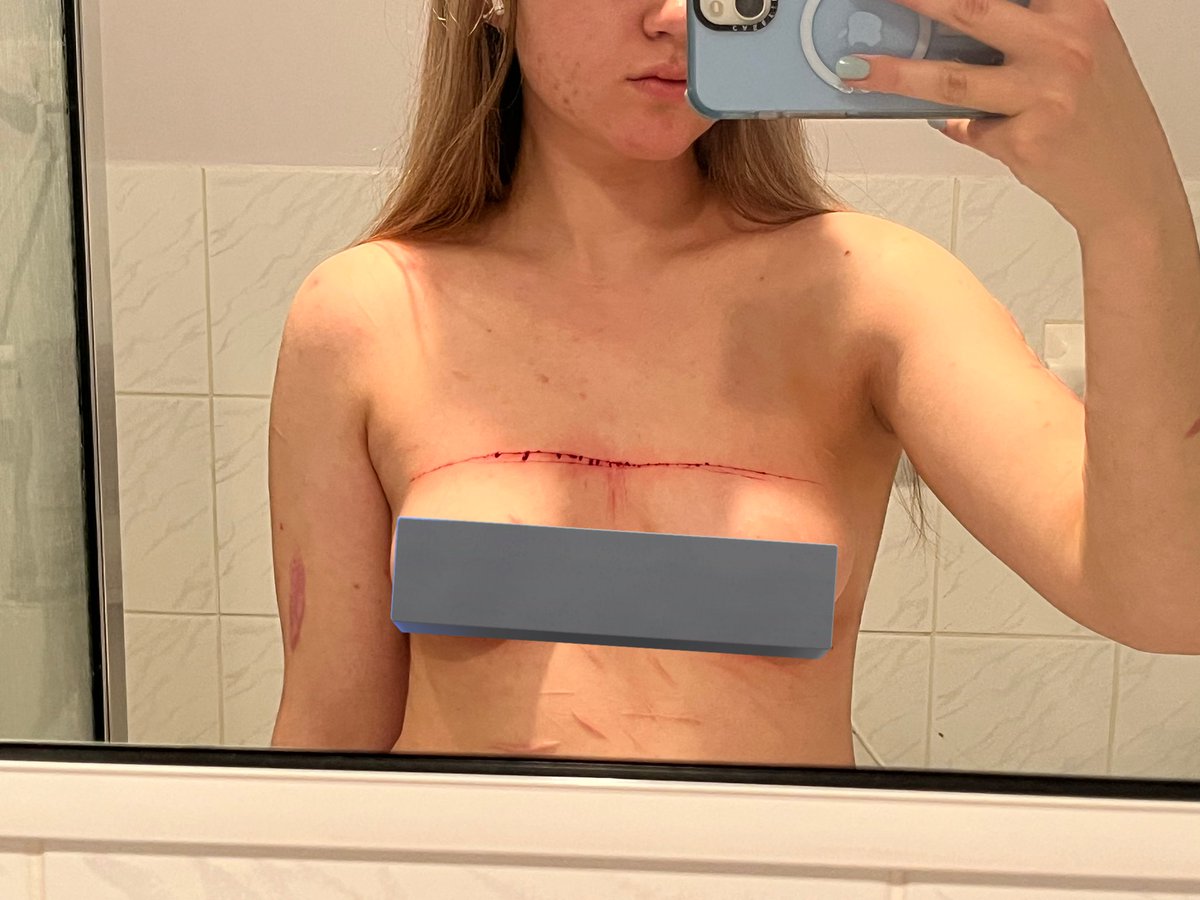 UnPerfect_blue's tweet photo. Claiming my body as mine because nobody will ever want me. I look so pretty. 988twt https://t.co/mU6jr76o35