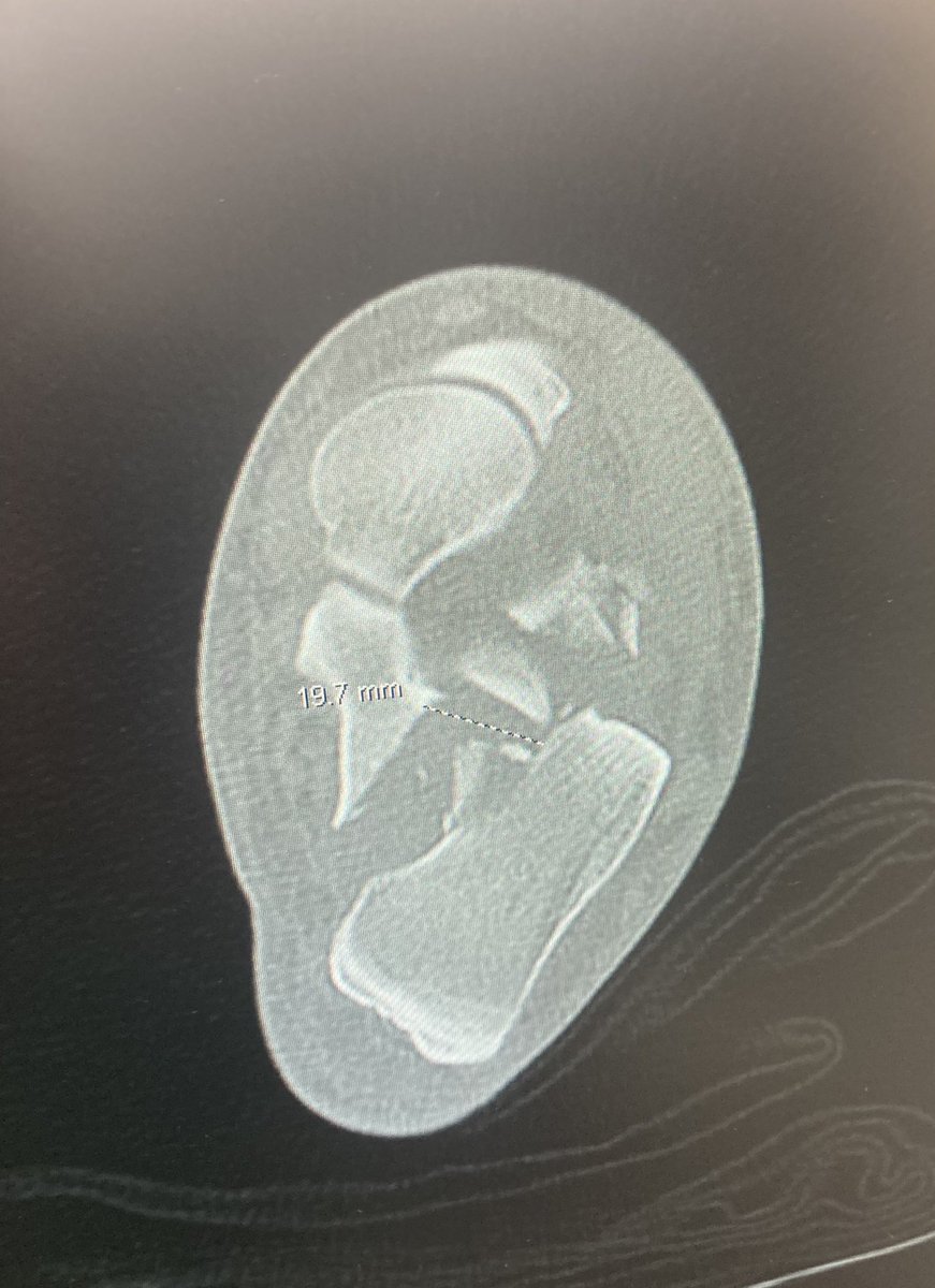 Eitan Ingall tweet media