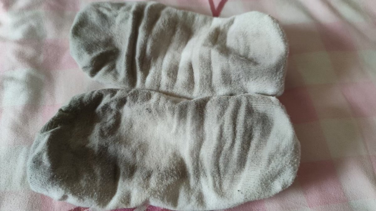 小姐姐夏天臭鞋子捂出来的效果，快凑过来