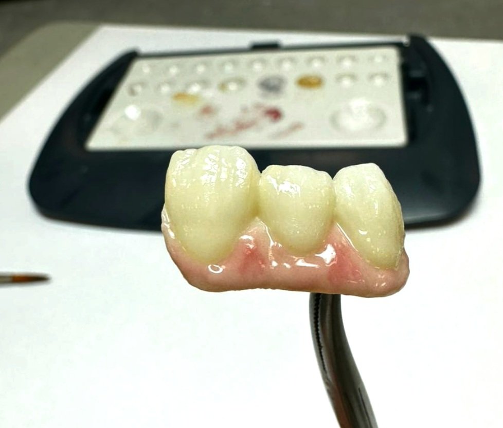 k25yy's tweet photo. Before :                                    After : 

🎨🦷🤩💛
#Dental #Artist https://t.co/OBXk0TJ6zo