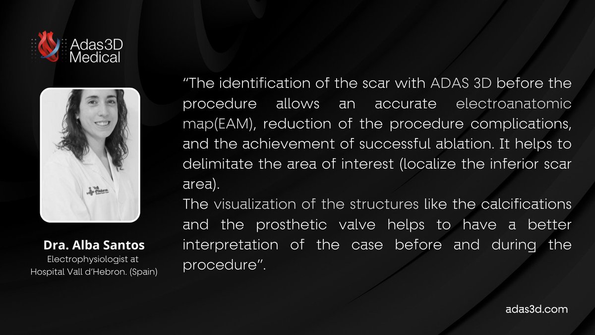 Thank you, Dra <a href="/AlbaSanor85/">Alba</a> (Vall d'Hebron Hospital, Spain) for sharing this case with us. 
You can find the entire procedure at this link: bit.ly/3P31bin

  #ventriculartachycardia #epees #ADAS3D