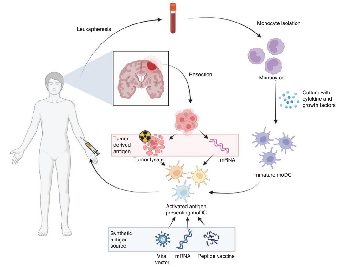 Dendritic cell vaccine trials in gliomas: Untangling the lines
academic.oup.com/neuro-oncology…