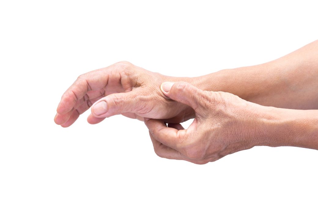 Announcing a Stanford University initiated study evaluating ActiPatch's ability to reduce thumb carpometacarpal joint osteoarthritis pain."Pulsed Electromagnetic Field (PEMF) Therapy in Thumb CMC Arthritis"ClinicalTrials.gov: NCT05315297  #arthritis #painrelief #stanford #oa