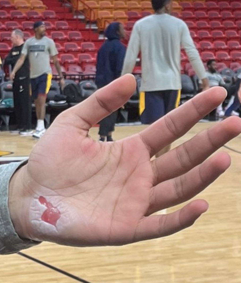 NBACentral on Twitter "Jamal Murray has a floor burn on his hand 😳