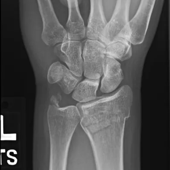 radRounds's tweet photo. What is the diagnosis?  Answer = https://t.co/YUXLp7Dieh https://t.co/R24BTTYn4K