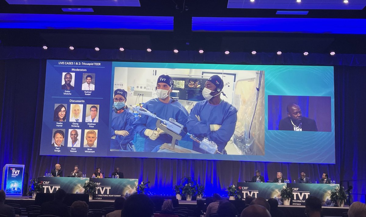 Good morning from #TVT2023! Live case from ⁦@cliniquepasteur⁩. #TricuspidTEER ⁦@didier_tchetche⁩ ⁦@matthewjpricemd⁩ ⁦@HamidNadira⁩ ⁦@psorajja⁩ ⁦@whisenant_brian⁩ #CardioEd