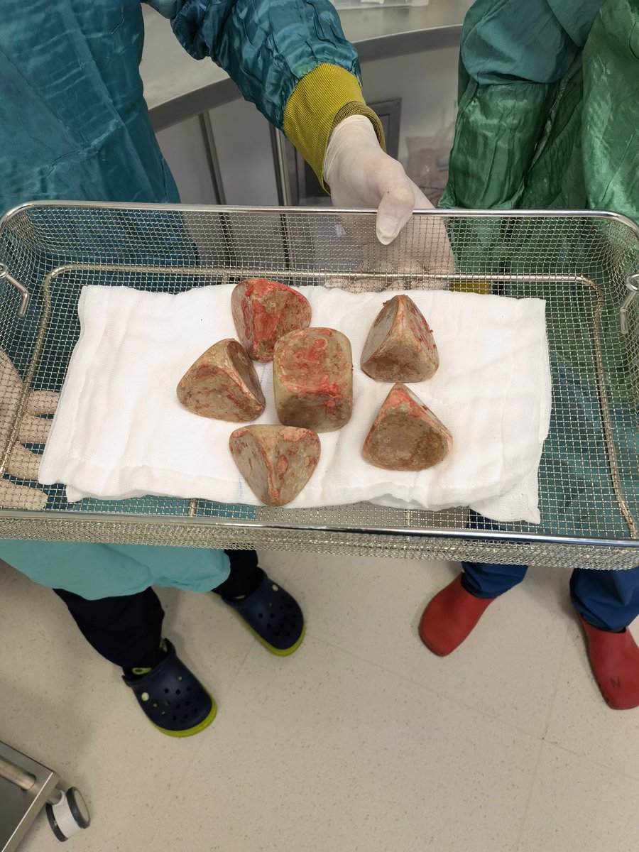 Una piedra más y lo llevan a Teotihuacán