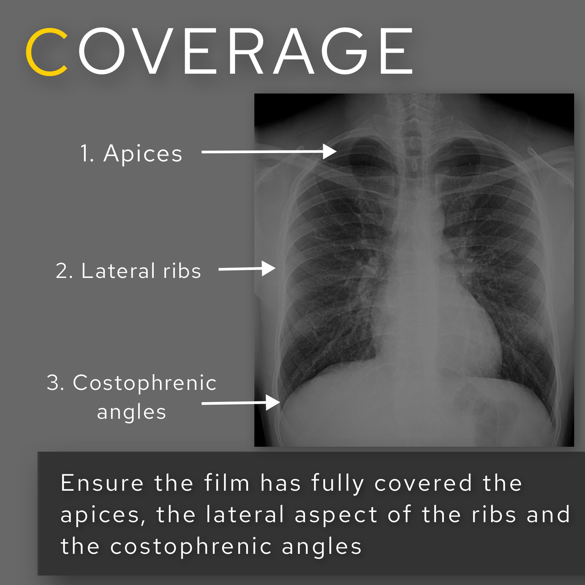 theRadiologist on Twitter "RIPEC Mnemonic to assess adequacy of a