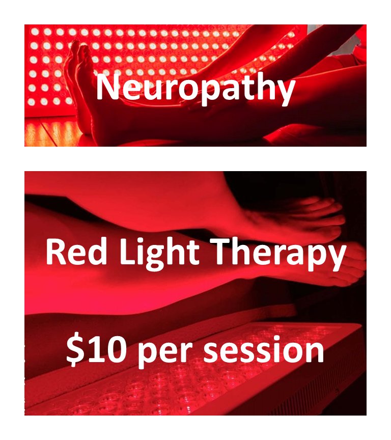 #Neuropathy is helped with Red Light Therapy. Medical grade equipment, no EMF! #medicalgrade #noemf #psoriasis #PTSD #Pain #painmanagement #SAD #scars #stretchmarks #Skinhealth #reiki #IRSauna #CBD