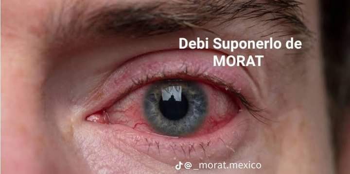 Tal cual, esa soy yo