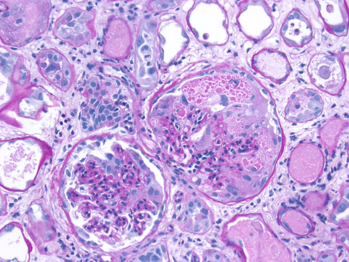 Kuang-Yu Jen, MD, PhD tweet media