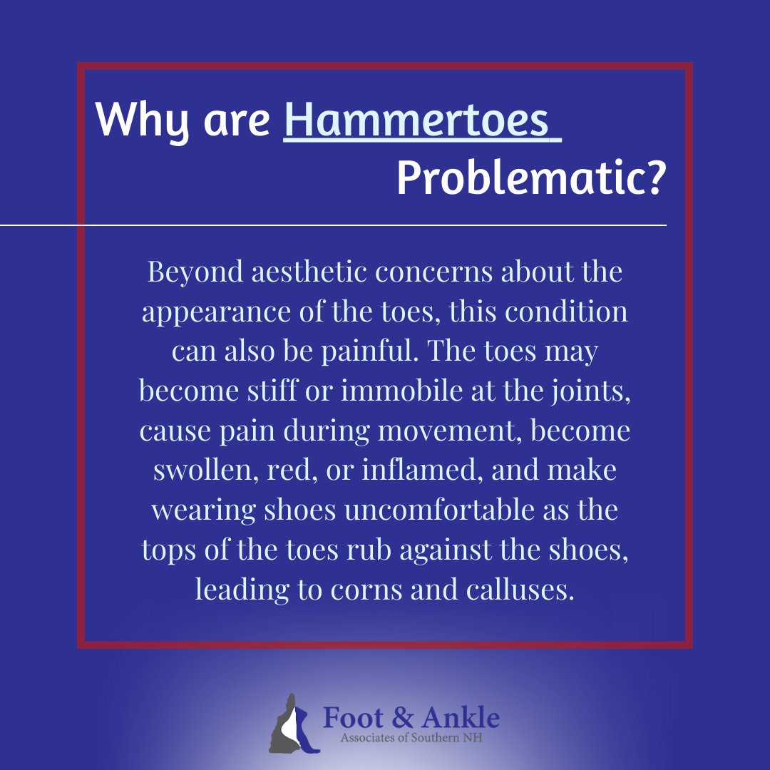 #footdeformity #hammertoe #hammertoetreatment #podiatrist #podiatrylife #podiatryclinic #footandanklespecialist #footandankle #NewHampshire #podiatrypractice #bestdoctors #bestpodiatrists #healthcare #footdoc #FootAndAnkleAssociatesOfSouthernNewHampshire #FAASNH