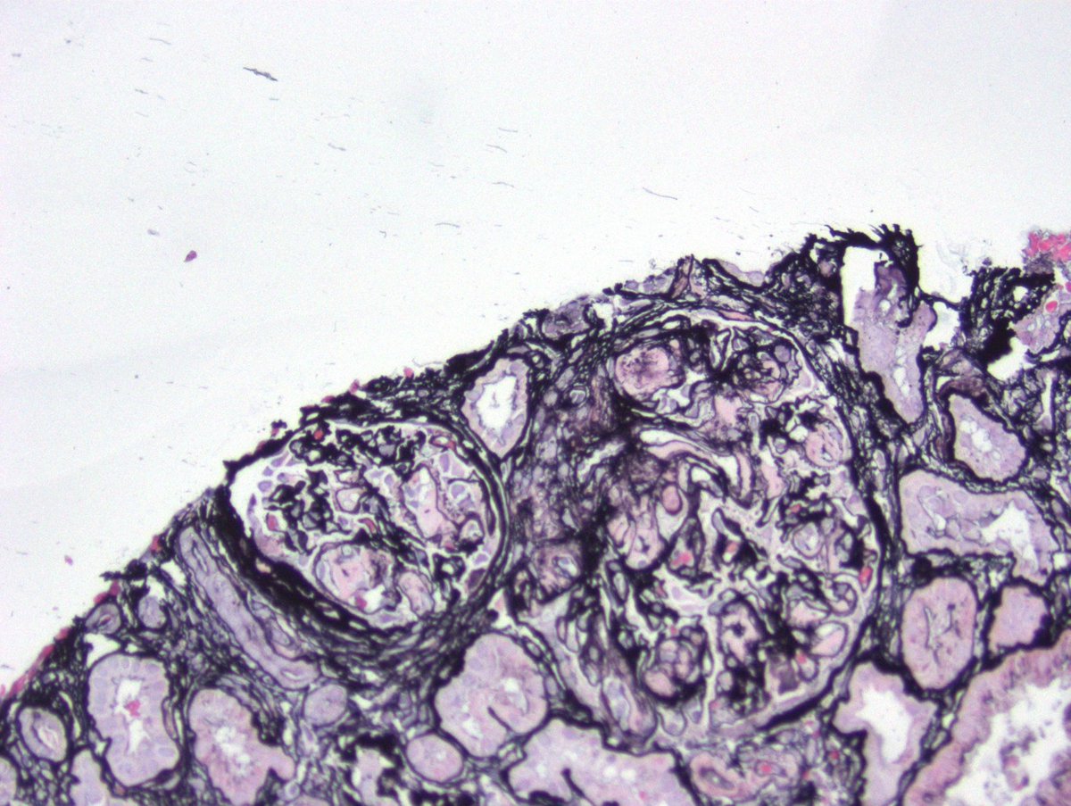 Kuang-Yu Jen, MD, PhD tweet media