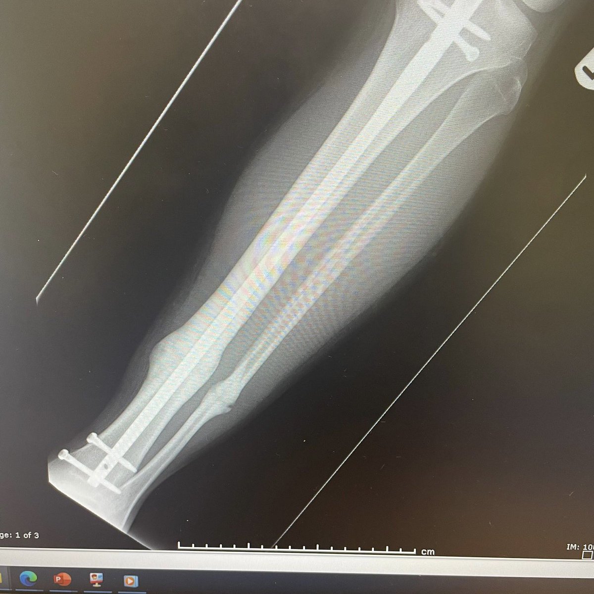 Mulbarton FC (Men’s) tweet media