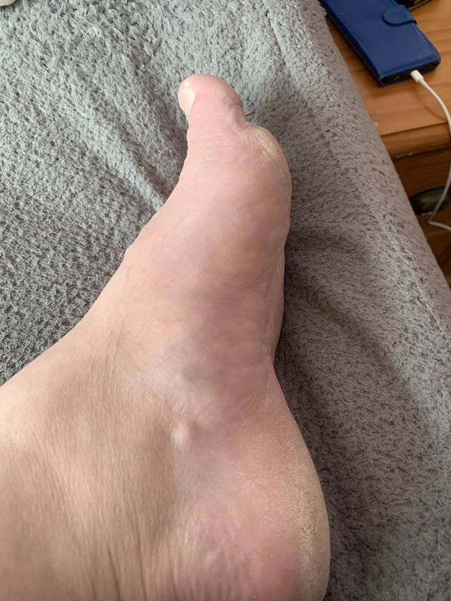 MasterJohnUK's tweet photo. For all you foot lovers it’s time to admire, goon, drool and most importantly SEND
£MasterJohnUK 

https://t.co/W22yjN9kfB
#findom #foot #cashmaster #toes #soles #foot_lover #paypig #finsub #foot_ @BestFootMasters @rt4dom @CockyStr8boyz @RTSub55245573 @JJ94JJJ @alpha_amplifier https://t.co/oeo6lex44L