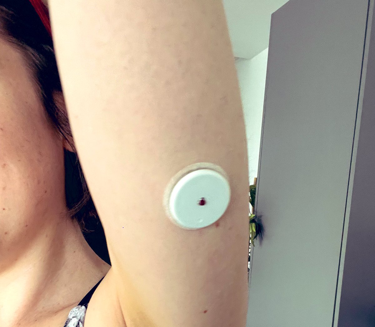 Popping the libre arm cherry. Next 14 days are all about avoiding doorframes and agressive toweling & jacket dressing. Any tips welcome…. 💙 #libre #diabetestech #gbdoc