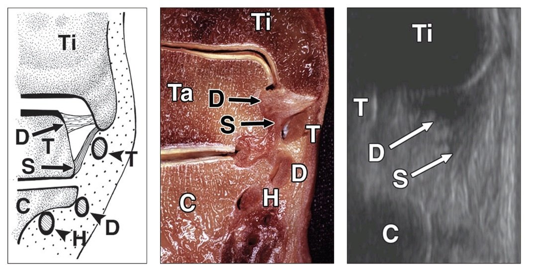 Sonography of the Normal  Ankle: A Target Approach  Using Skeletal Reference Points

FREE PDF

ajronline.org/doi/pdf/10.221…