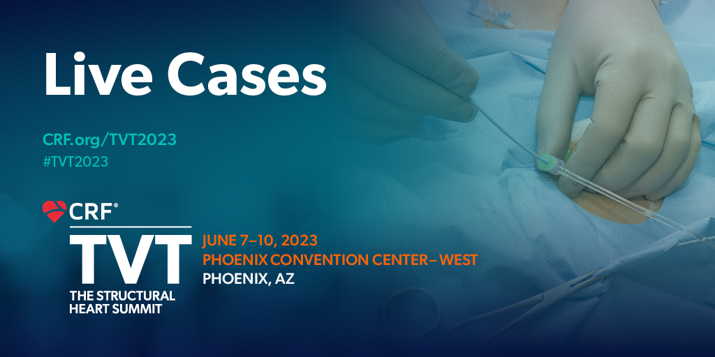 This afternoon's #livecases cover various innovative techniques in #structuralheartdisease. Join us at 2:00 PM in Room 301A-B! #TVT2023 🔸#Mitral TEER 🔸#TAVR Complex Anatomies and Surgical Valve Failure 🔸#LAAO @DrTomWaggoner @caresans26 @StevenYakubov @SusheelKodaliMD @docsaw