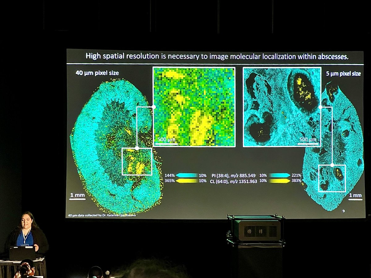 JeffSpraggins's tweet photo. So happy for Jackie! Her presentation at #ASMS2023 on our work with @EricSkaar and @vandeplaslab on how infection alters tissue microenvironments was simply stunning. Way to rep our lab and @VanderbiltChem @VanderbiltCDB https://t.co/PtAVi6nWEc