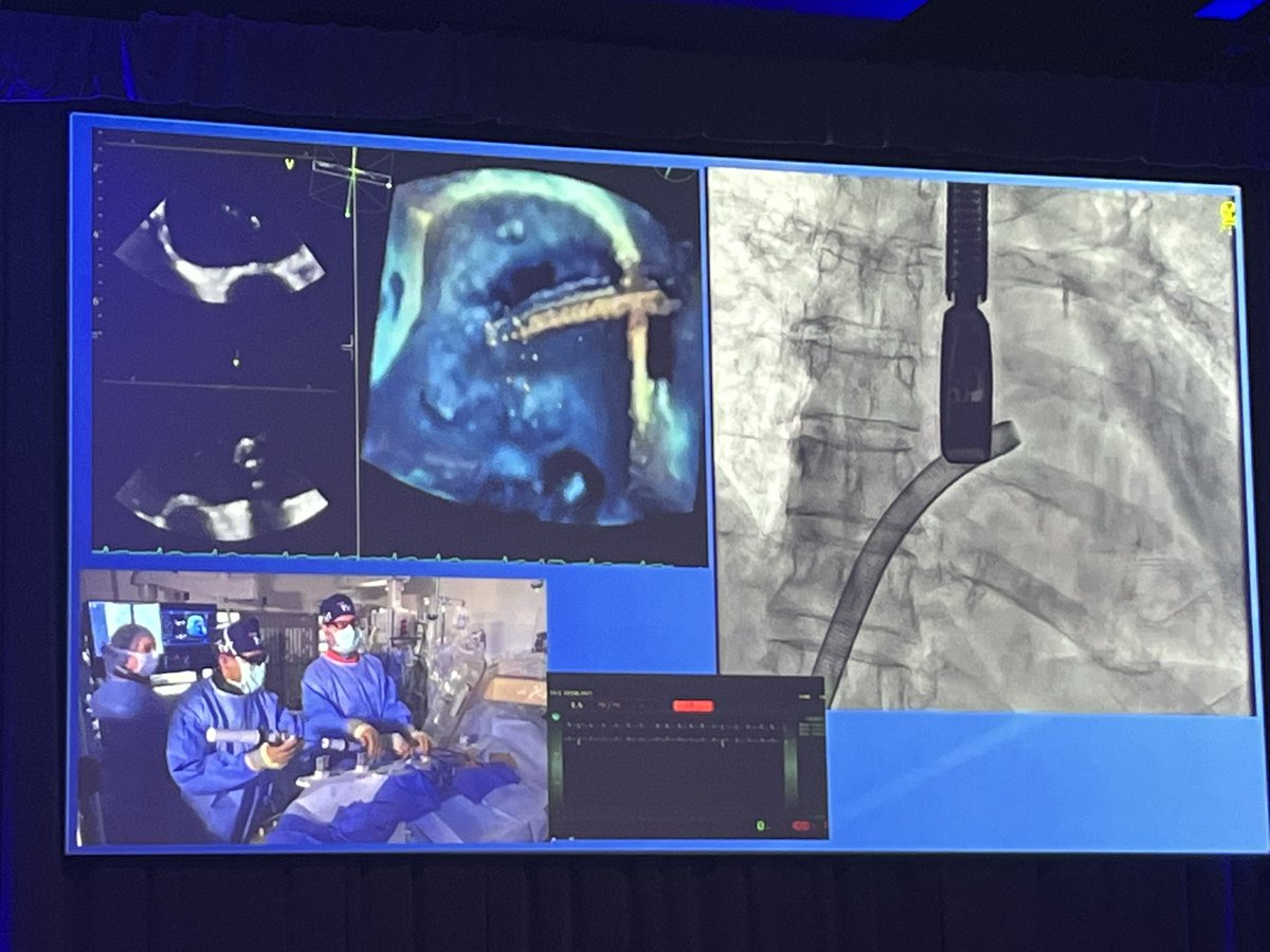 Cardiovascular Research Foundation tweet media