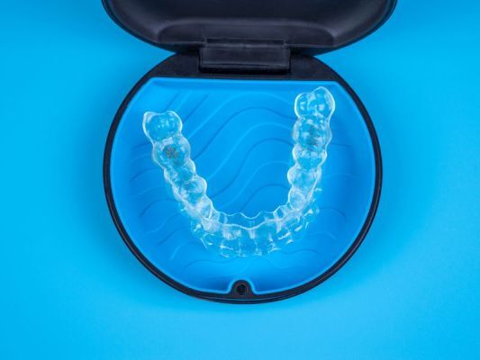 Những trường hợp không nên áp dụng niềng răng trong suốt
Răng bị quặp hơn và hô hơn 45 độ
Răng thưa nhiều, khoảng cách giữa 2 răng lớn hơn 6mm
Răng bị mất sự cân đối hay cắn chìa nặng.
bit.ly/45B8mUE