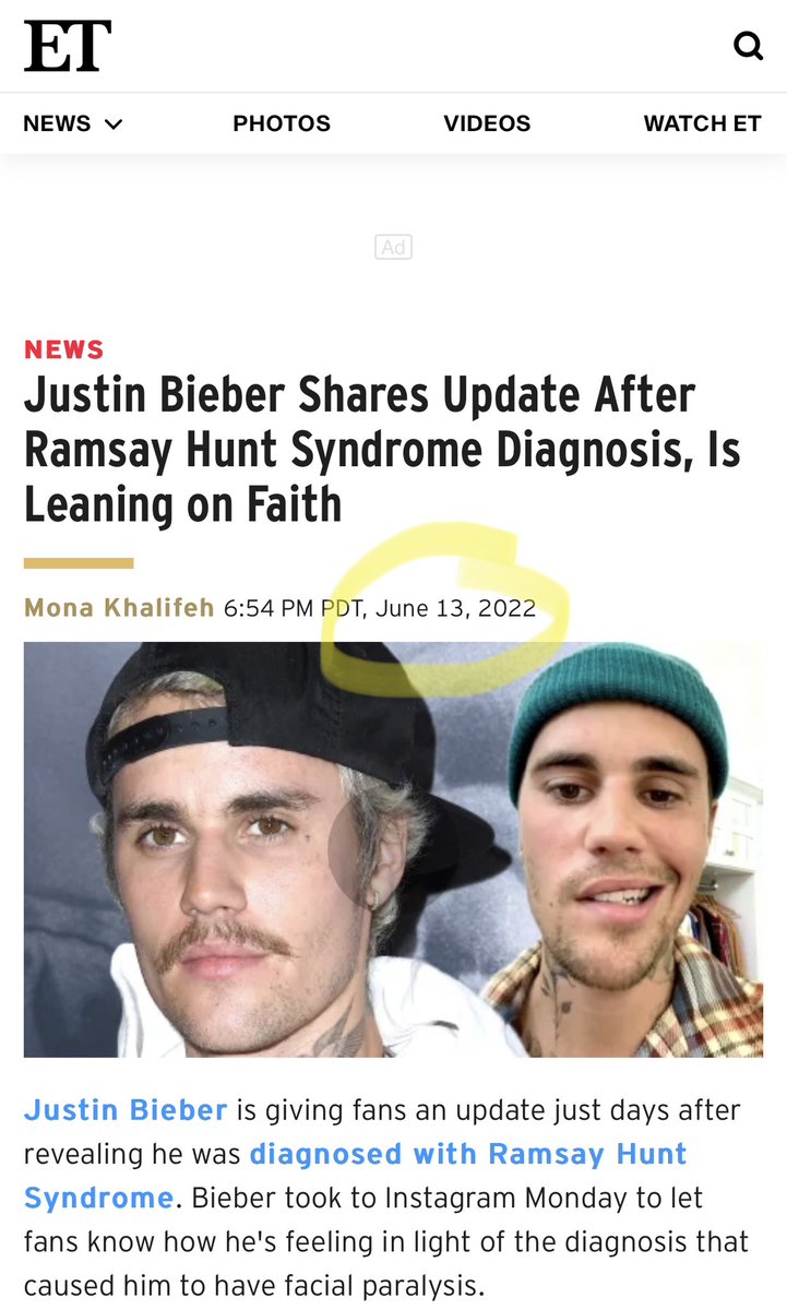 thevivafrei's tweet photo. Remember when Justin Bieber suffered from Ramsay Hunt and his wife had a blood clot within 3 months of each other? https://t.co/KlPq4QH5dk