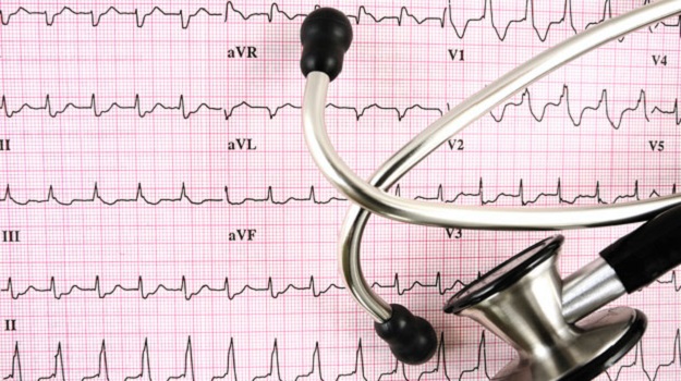 If you want to continue to sharpen your ECG skills, check out ACC's ECG Drill and Practice! This program reviews key findings in clinical electrocardiography and also contains a self-assessment ECG test. Learn more: bit.ly/3Q1ck1l #ACCAthleticHeart