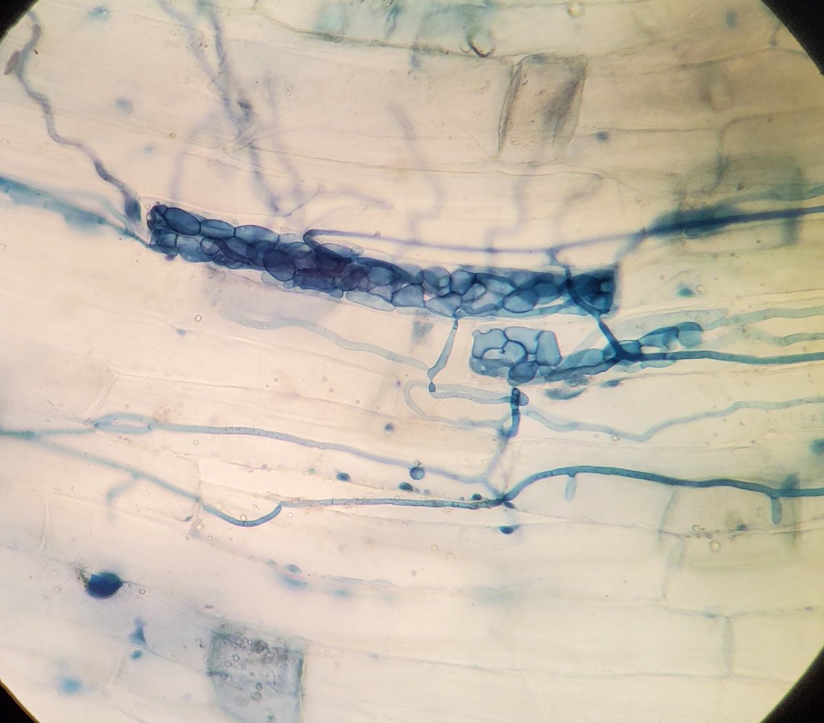 gracelbotany's tweet photo. Have any fungi people come across these weird clustery hyphae things? These were found during root staining of 1 yr old greenhouse-based plants inoculated with #AMF . Pic 1 is 10x, pic 2 is 20x. We are all unsure how to categorize it in the lab! https://t.co/GLWrsQUu3N
