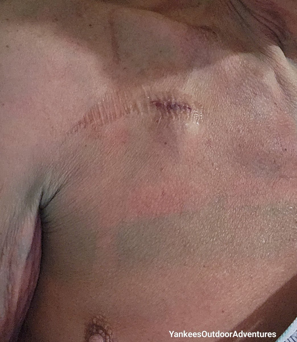 Yankee (Maèxelawèn Osapèkwinùnt) tweet media