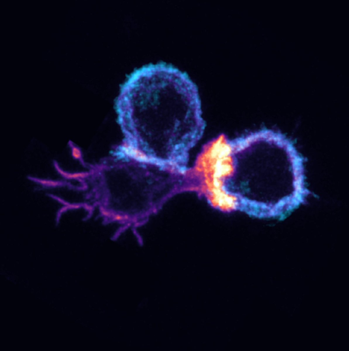 Don't know how this T cell (in violet) chose between both cancer cells (in blue) but it clearly had its preference and decided to form a huge actin protrusion on its favorite ☠️♥️

#FluorescenceFriday #SciComm #Microscopy