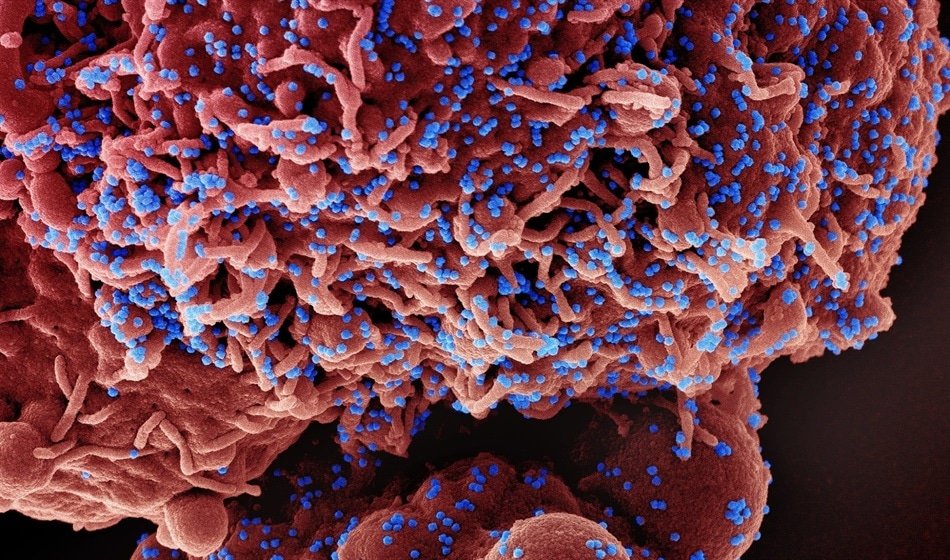 SARS-CoV-2 hijacks body's metabolism to amplify COVID-19 severity

Article :
news-medical.net/news/20230609/…